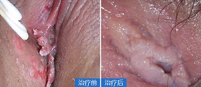 anli_05.jpg