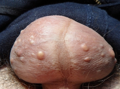 blob.png
